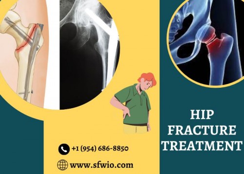 Hip-Fracture-Treatmentddde68d1e965321c.jpg