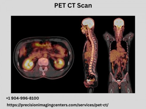 PET-CT-Scan8dc64809c5dde609.jpg